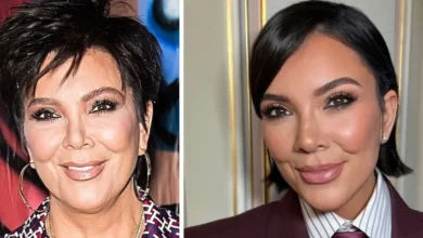 Kris Jenner Face Lift