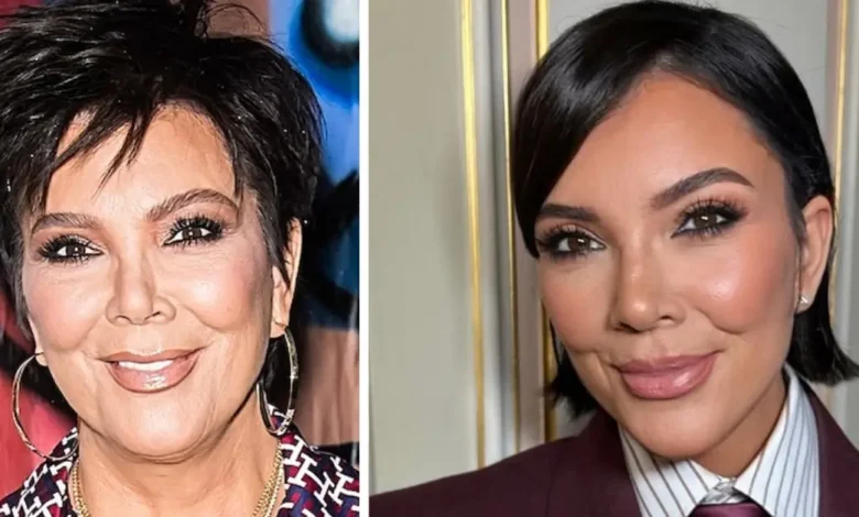 Kris Jenner Face Lift
