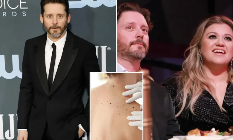 Brandon Blackstock Illness Cancer